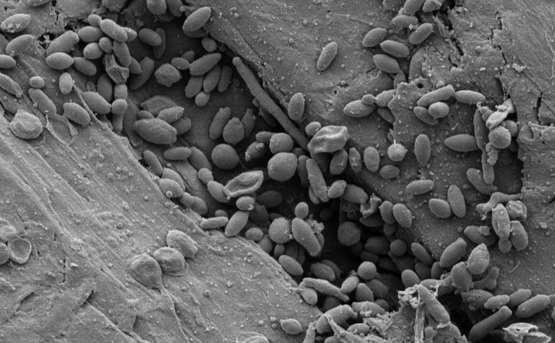 Electron micrographs of the inside wooden surface of a wine barrel after the fermentation of beer 