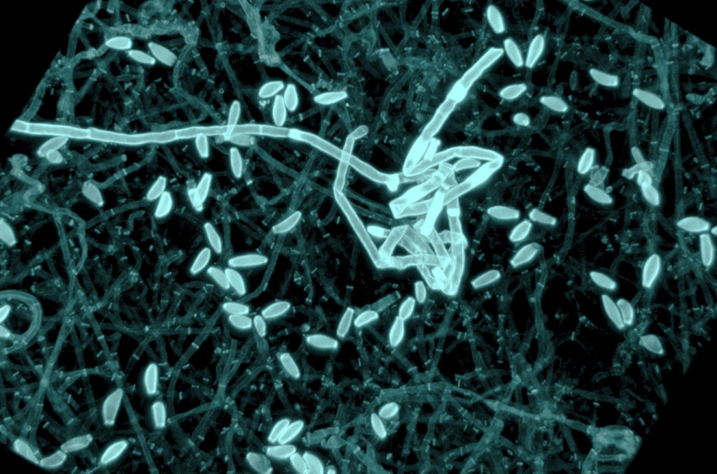 A 3D projection of Pseudogymnoascus destructans mycelia and conidia from confocal imaging 