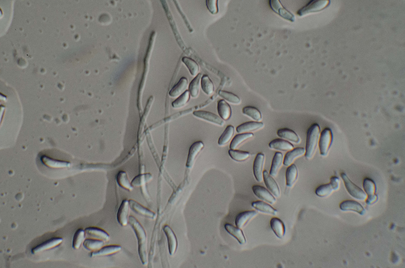 Pseudogmnoascus destructans mycelia and conidia