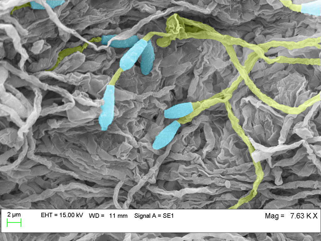 pseudogymnoascus destructans in color