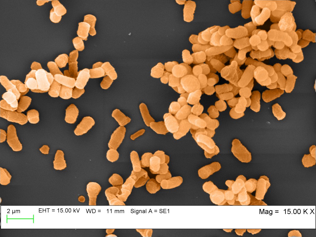 pseudo colored scanning electron micrograph of R rhodochrous fermentations cells