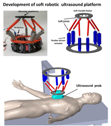 3 images showing the robotic ultrasound device and placement above a body